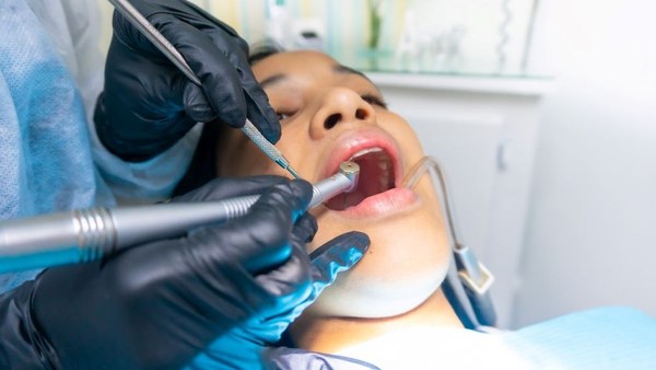 5 redenen waarom je naar de tandarts moet